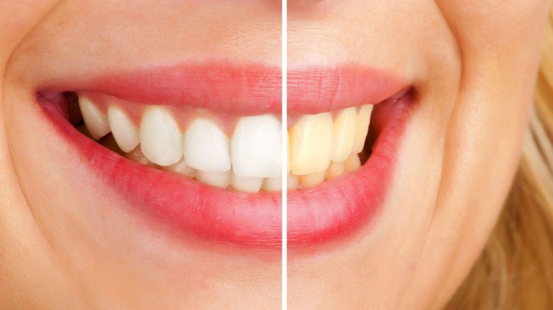 Aqui tienes unos utiles Tips para blanquear los dientes de forma natural