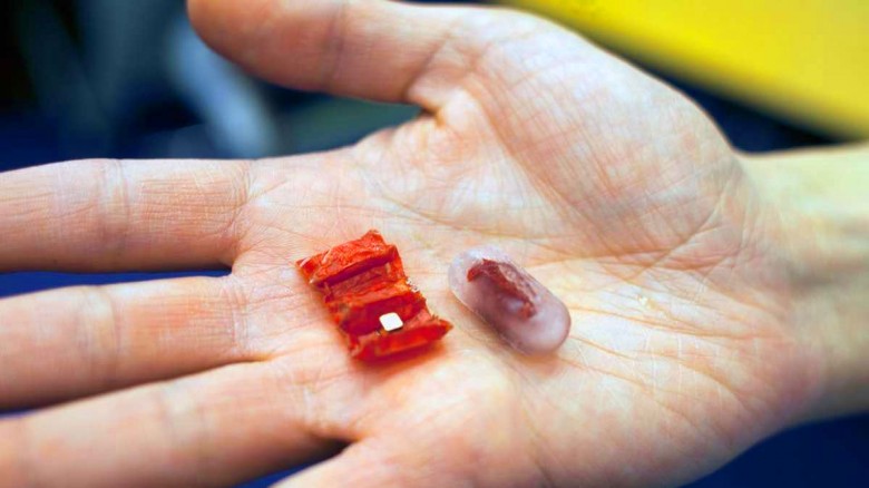 Estos científicos encontraron la manera de insertar un robot en tu cuerpo… y se lo deben al origami