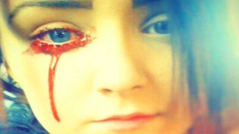 Mira esta niña que llora sangre y los médicos aun no saben como tratarla