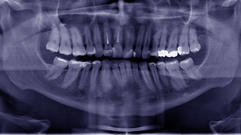 Este nuevo tratamiento podría servir para que los dientes se reparen por su propia cuenta